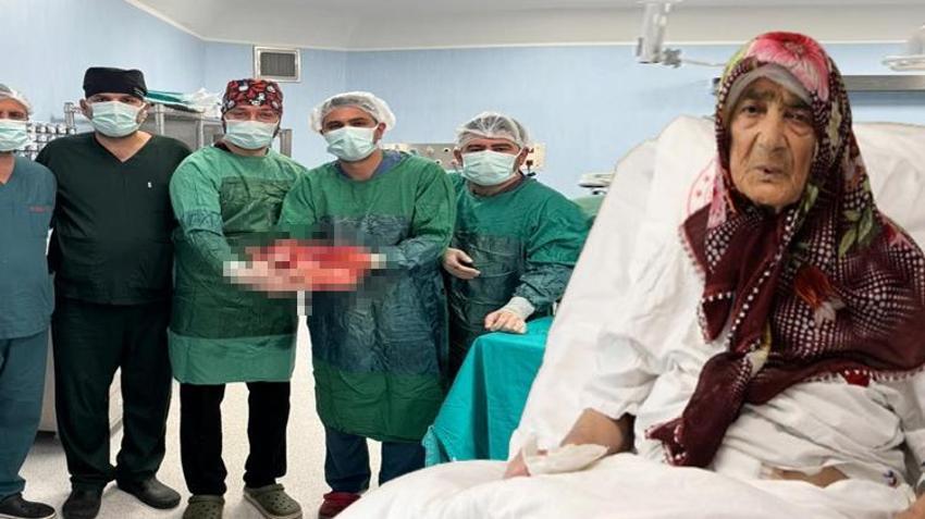 Karın ağrısı şikayetiyle gitti, gerçek hastanede ortaya çıktı! Doktorlar bile şaşkına döndü
