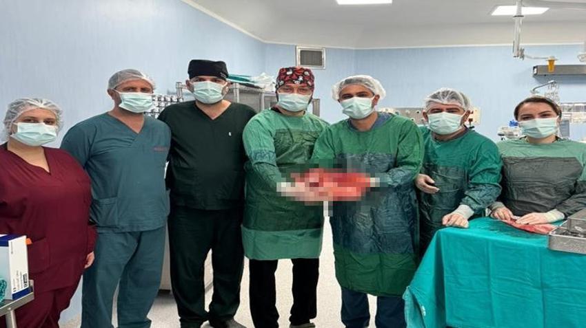 Karın ağrısı şikayetiyle gitti, gerçek hastanede ortaya çıktı! Doktorlar bile şaşkına döndü