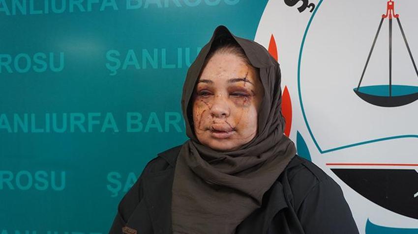 Eşinden şiddet gören kadının yüzü tanınmaz hale geldi! 'Vicdanı olan herkesten yardım istiyorum'