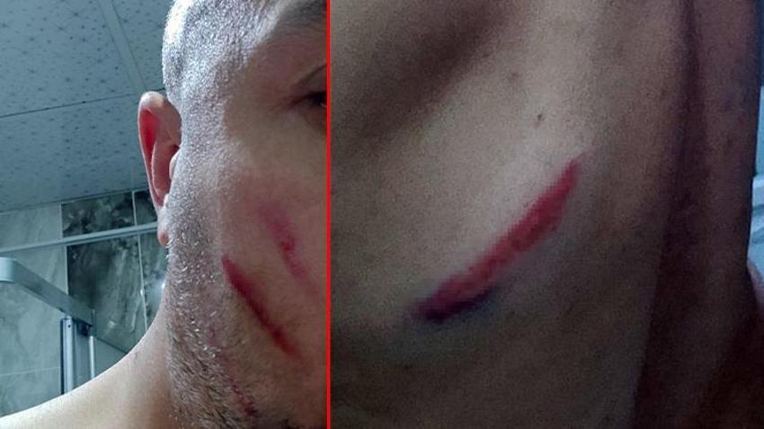 Karakoçan'da otobüs şoförü ile esnafın kavgasının sebebi ortaya çıktı! O anlar kamerada