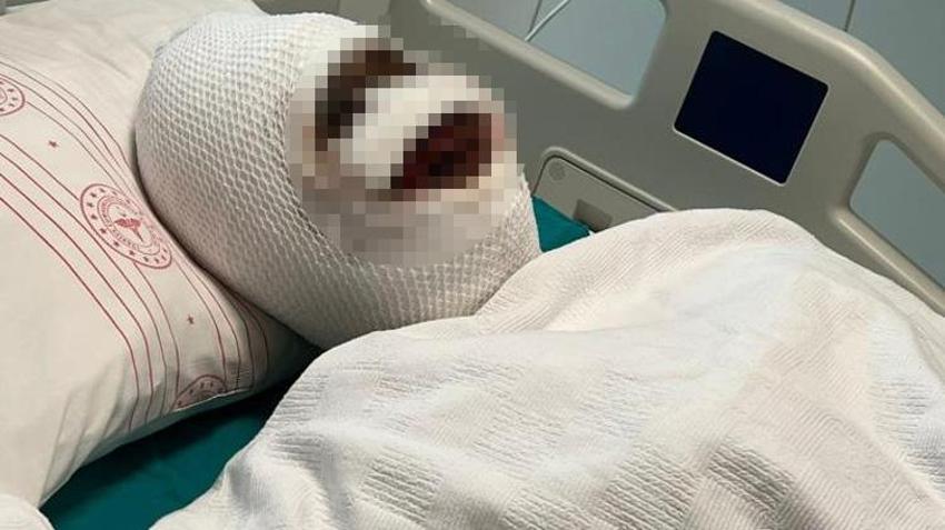 Gaziantep'te eski koca vahşeti! Genç kadını bağlayıp başına kezzap döktü