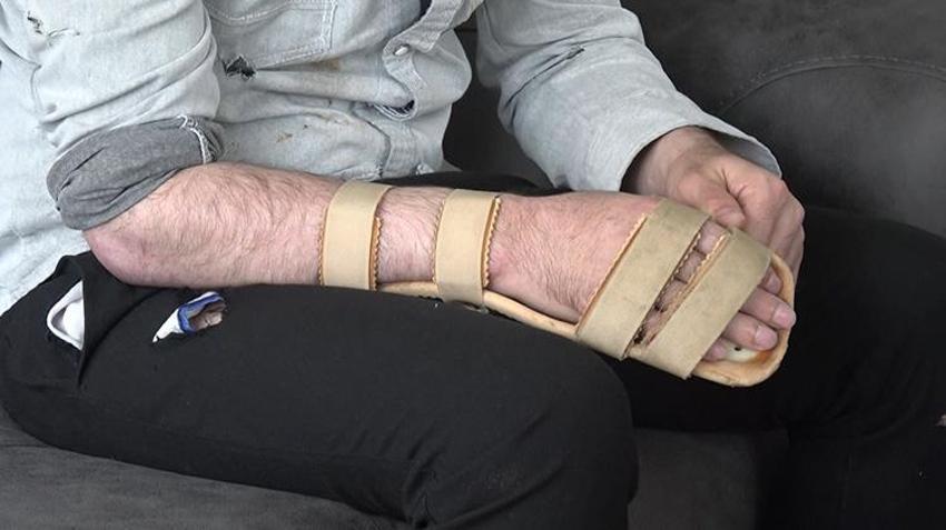 Başına metal parça saplanan işçi milyonlarca lira tazminat kazandı! Açıklamaları şaşkına çevirdi: 'Ailem beni yoğun bakımda bırakıp Suriye'ye gitmiş'