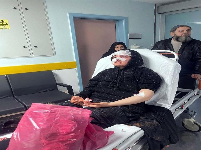 Boşanma aşamasında karısına yaptı: Gaziantep'te sokak ortasında kaldırım taşıyla dövdü!