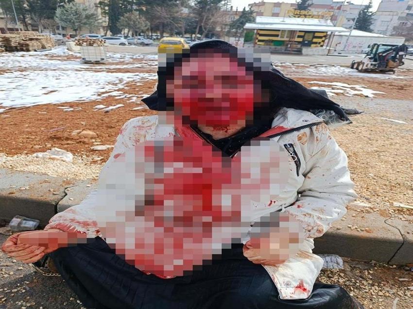 Boşanma aşamasında karısına yaptı: Gaziantep'te sokak ortasında kaldırım taşıyla dövdü!