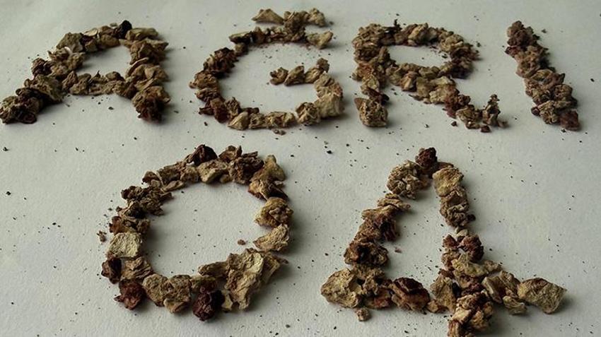 Sağlık çalışanları bile inanamadı! Daha önce 21 kez ameliyat oldu böbreğinden tam 295 taş çıktı!