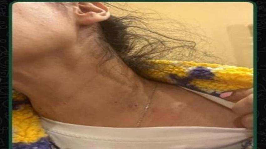 Ayrılmak istediği sevgilisi hayatını kabusa çevirdi! Evini basıp darbetti: 'Ölmek istemiyorum'