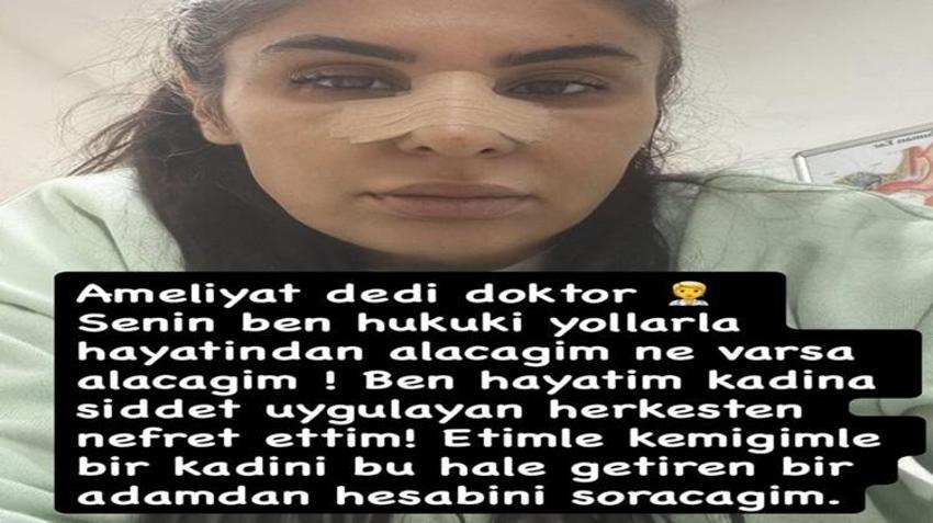 Ayrılmak istediği sevgilisi hayatını kabusa çevirdi! Evini basıp darbetti: 'Ölmek istemiyorum'