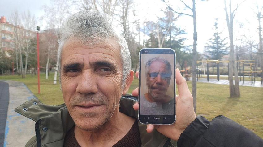Kayseri'de cinsel istismarcı Jeffrey Epstein'e benzeyen adam isyan etti