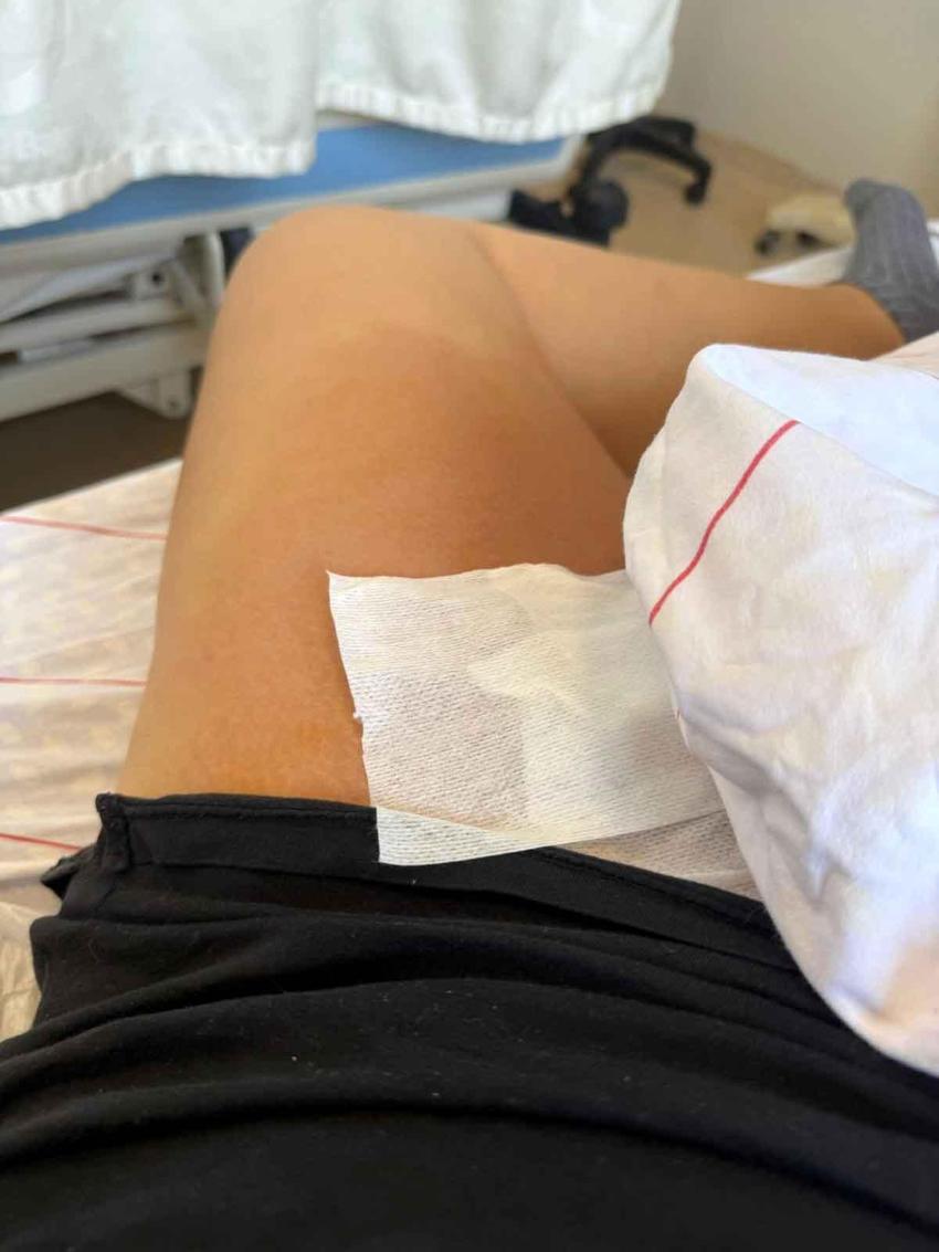 Lazer epilasyon kabusu! Ameliyatlık oldu, ölümden döndü: 'Yüksek atış yapacağız' dediler hayatını kararttılar