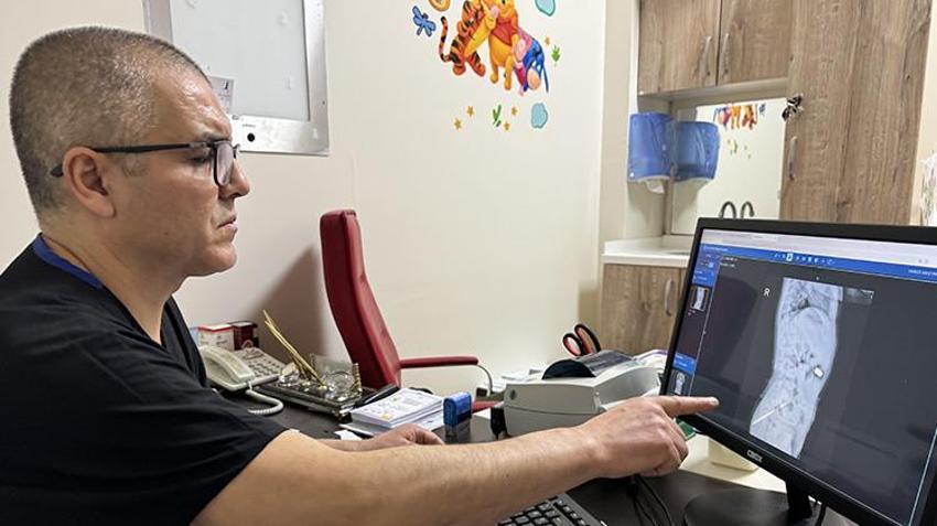 Karaman'da tuvaletini yapamayan çocuğun bağırsaklarından çıkanlar şoke etti