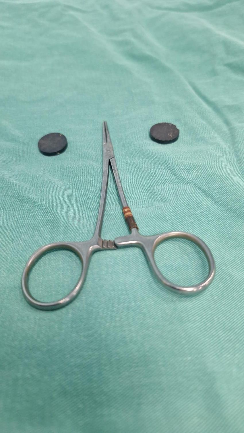 Karaman'da tuvaletini yapamayan çocuğun bağırsaklarından çıkanlar şoke etti