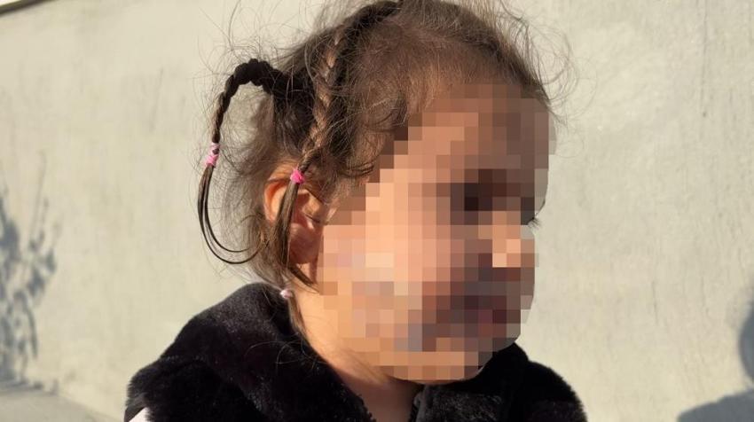 3 yaşında yüzü pençe ve ısırıkla doldu! İzmir'de köpek dehşeti
