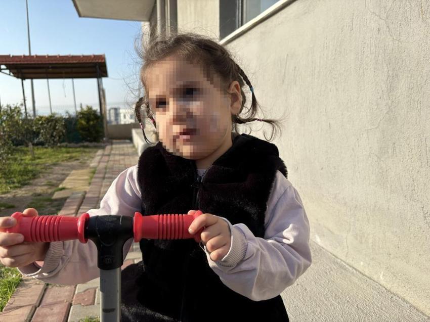 3 yaşında yüzü pençe ve ısırıkla doldu! İzmir'de köpek dehşeti