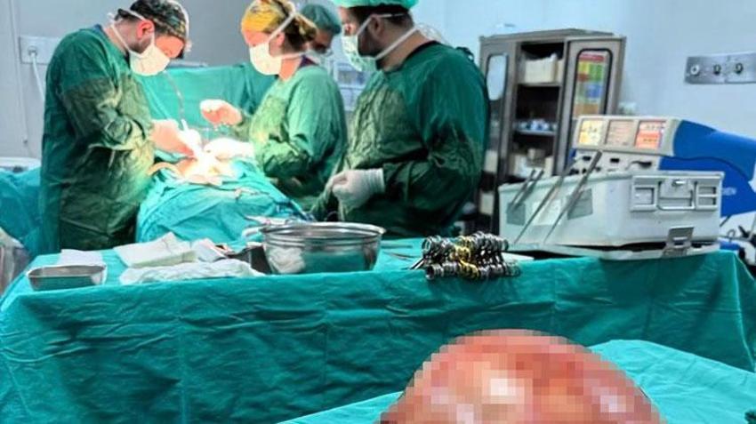 Van Yüzüncü Yıl Üniversitesi'nde bir kadının karnından 35 santimetrelik dev kitle çıkarıldı