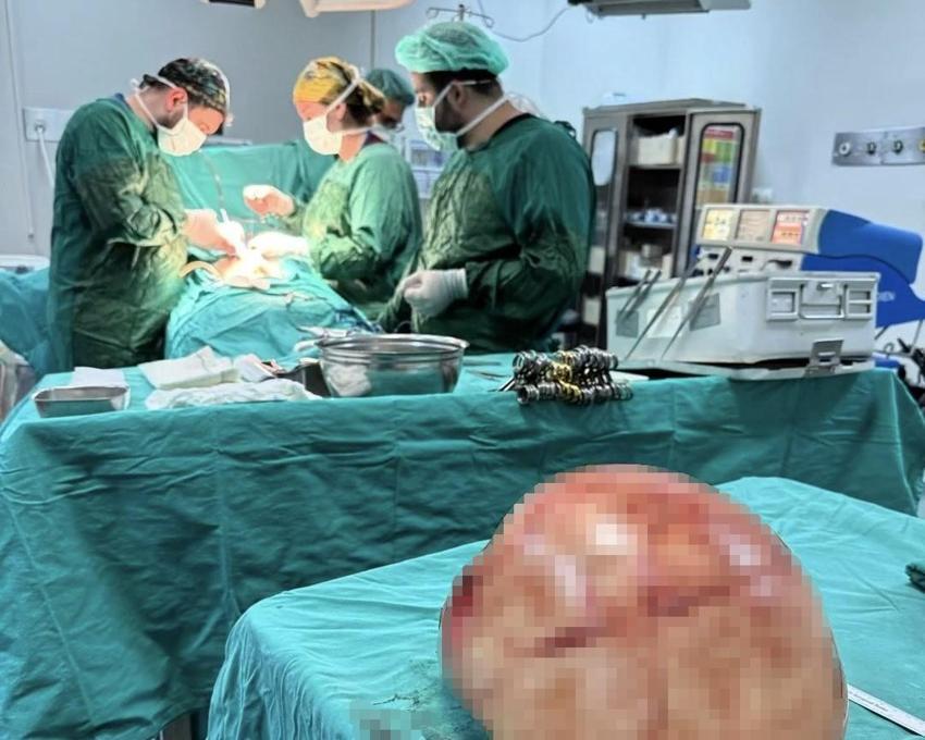 Van Yüzüncü Yıl Üniversitesi'nde bir kadının karnından 35 santimetrelik dev kitle çıkarıldı