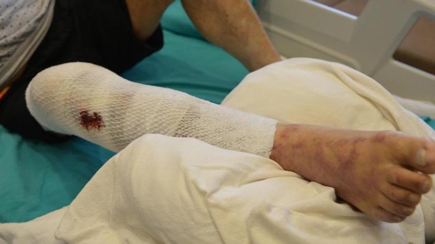 Lavabo açarken hastanelik oldu: 79 yaşındaki Halis Amca’nın acı tecrübesi: Bir paket döktü, hayatı karardı