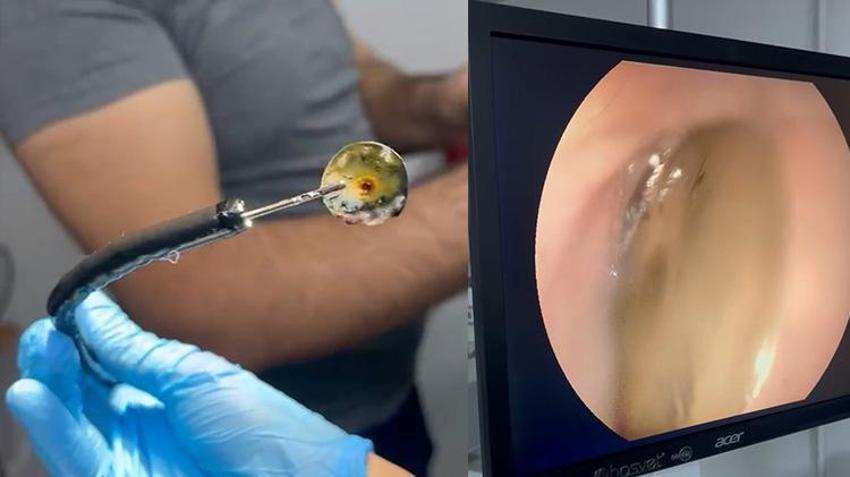 Kedinin 4 yıldır geçmeyen kusmasının sebebi tomografi ile ortaya çıktı!