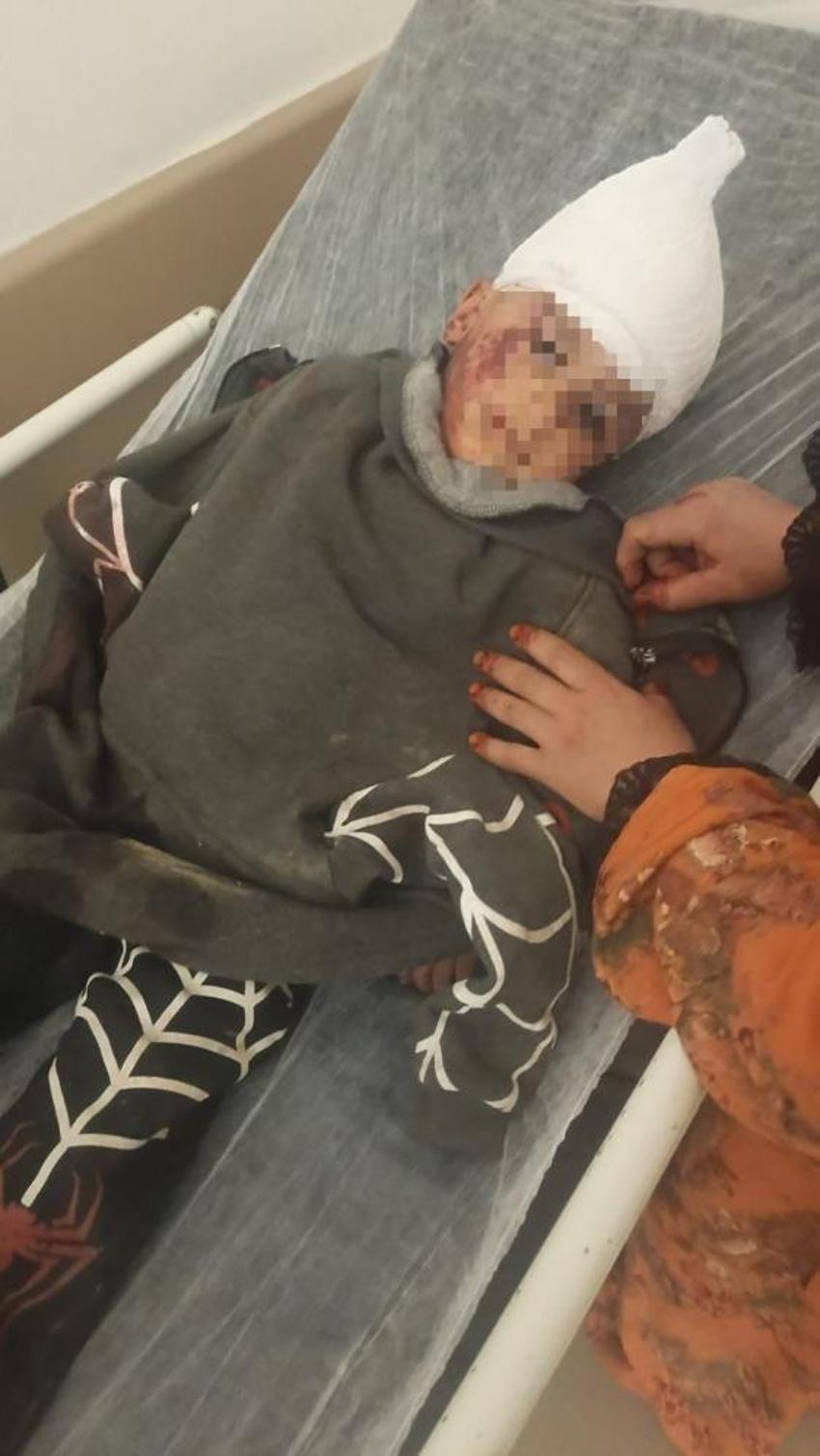 Kayseri'de görülmemiş olay! 12 yaşında dehşeti yaşadı, 3 ameliyat geçirdi!