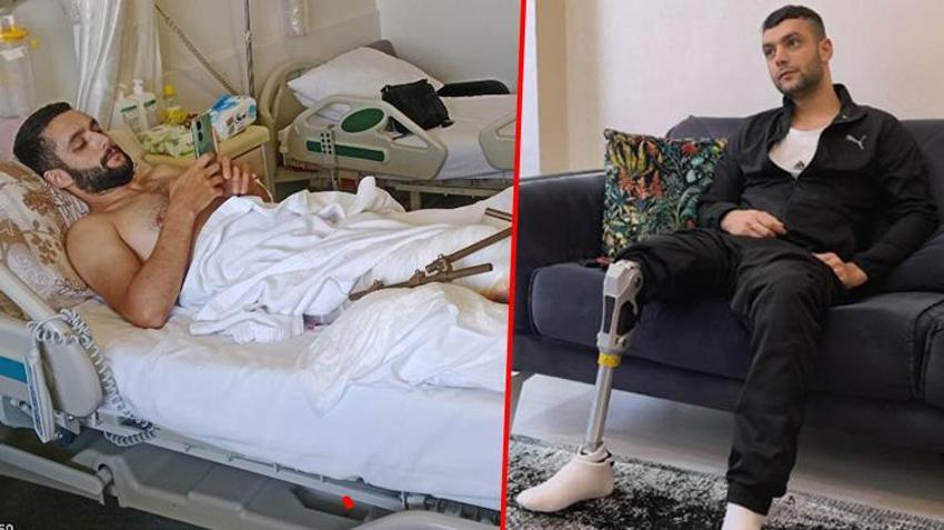 Motosiklet kazasında bacağını kaybetti! Bursalı hayırseverler yardımına koştu: Artık yürüyebilecek