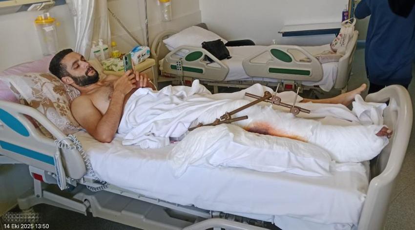 Motosiklet kazasında bacağını kaybetti! Bursalı hayırseverler yardımına koştu: Artık yürüyebilecek