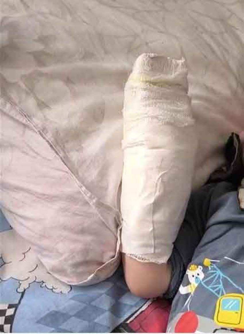 AVM'de korkunç olay! Yürüyen merdivene eli sıkışan çocuğun parmağı koptu