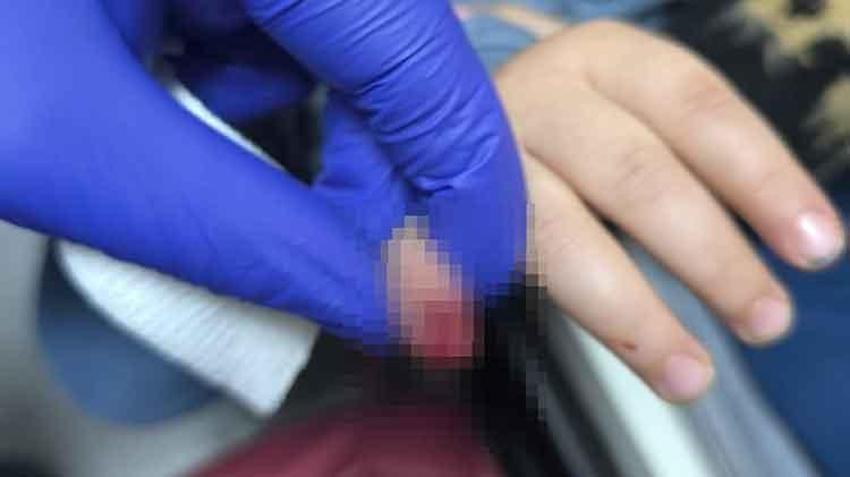 AVM'de korkunç olay! Yürüyen merdivene eli sıkışan çocuğun parmağı koptu