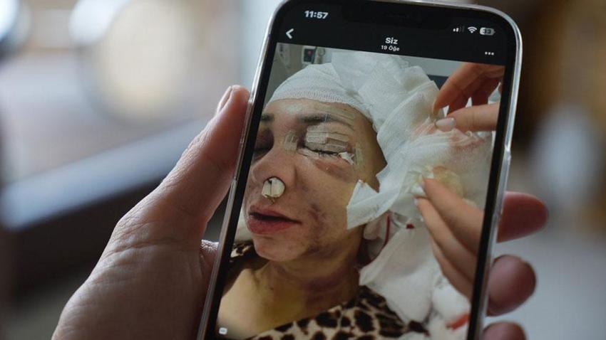 Bayramda 'küfretmeyin' diye uyaran anne ve oğlunu feci şekilde darp etmişlerdi; Meryem Yıldırım yaşadığı dehşeti unutamıyor