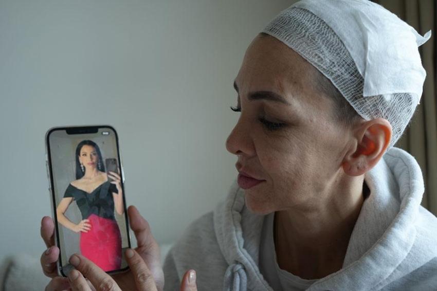 Bayramda 'küfretmeyin' diye uyaran anne ve oğlunu feci şekilde darp etmişlerdi; Meryem Yıldırım yaşadığı dehşeti unutamıyor