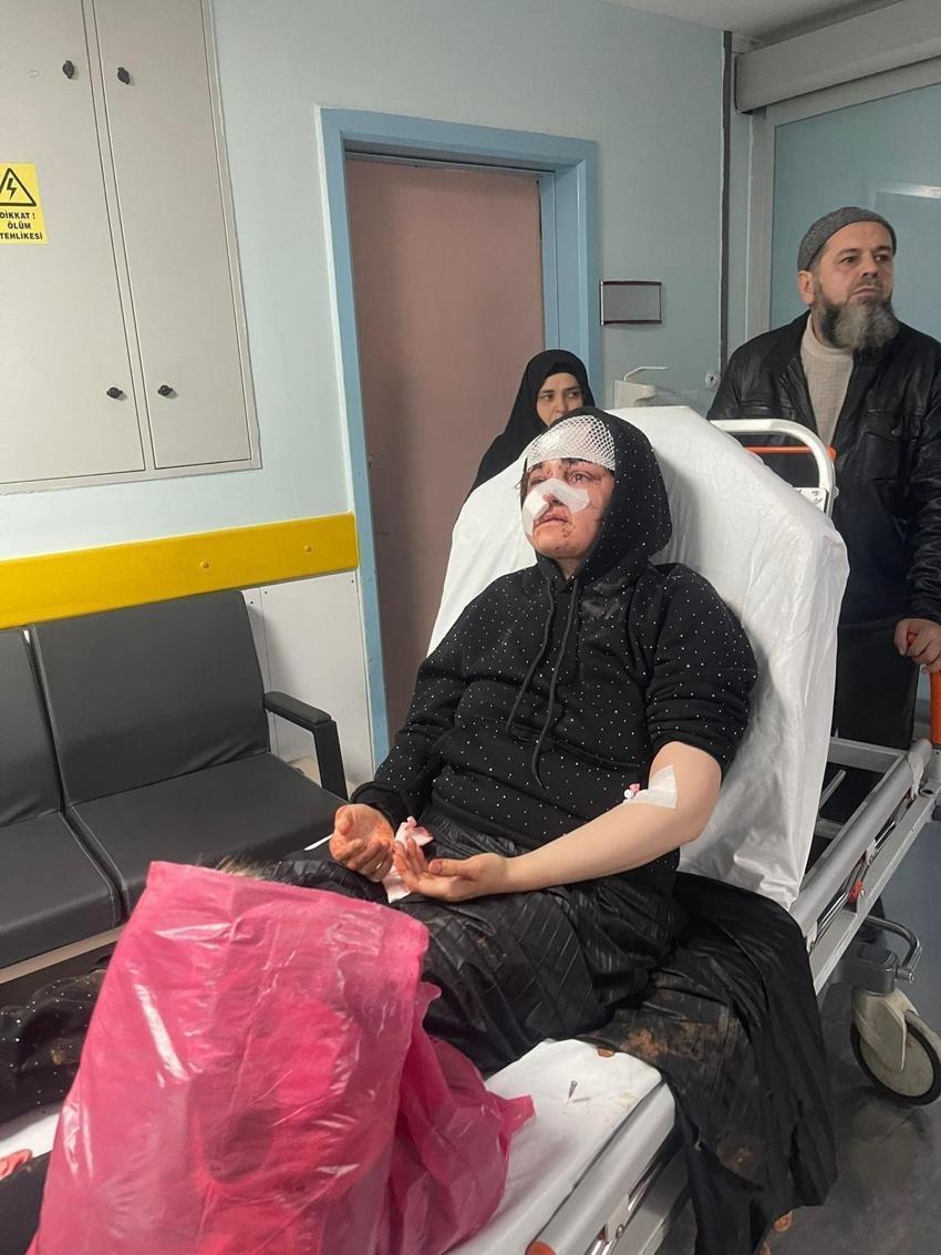 Gaziantep'te boşanma aşamasındaki eşinin yüzünü tanınmaz hale getirdi! Savcı kaldırım taşını silah sayıldığını belirtti