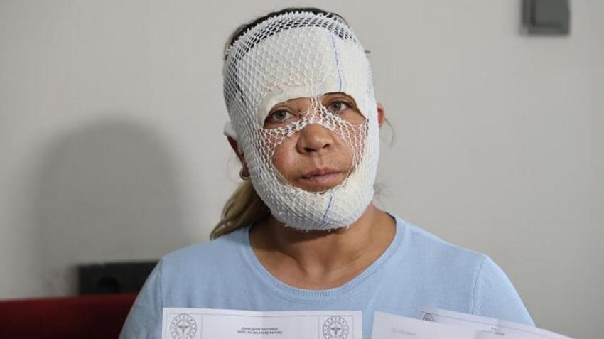 Güzelleşmek isterken kabusu yaşadı! 2 yaşındaki oğlu bile korkup balkondan düştü