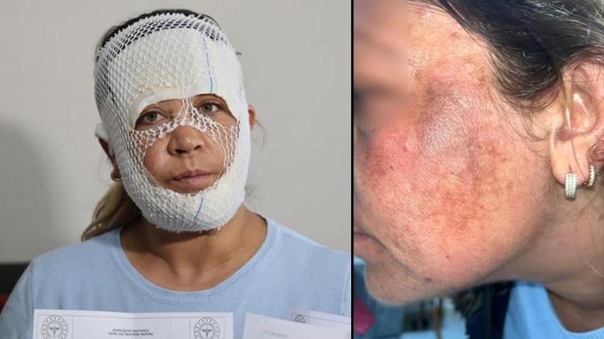 Güzelleşmek isterken kabusu yaşadı! 2 yaşındaki oğlu bile korkup balkondan düştü