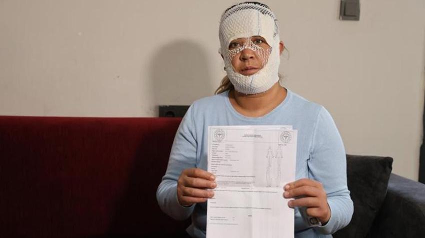 Güzelleşmek isterken kabusu yaşadı! 2 yaşındaki oğlu bile korkup balkondan düştü