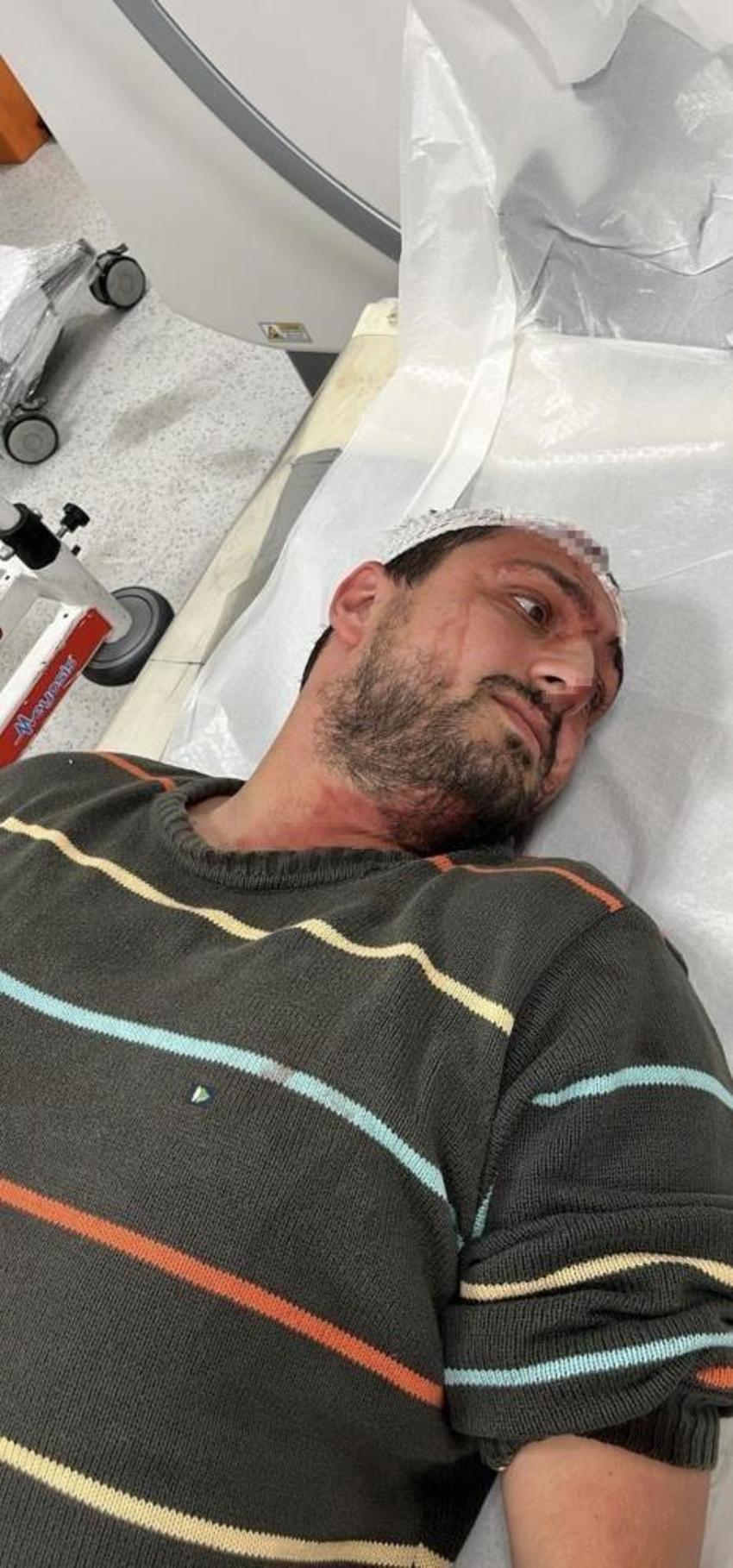 Kocaeli'de engelliye dehşet dayak: 30 dakika boyunca odunla dövdü!