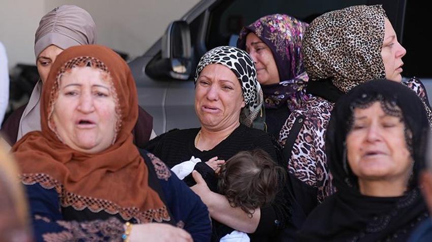İzmir'de burun estetiği can aldı! Özel kurum hakkında inceleme başlatıldı