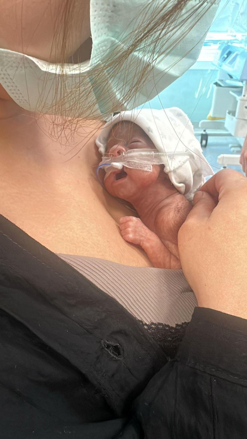 Antalya'da 650 gram doğan 'Leyloş bebek' hayata tutundu! 24 haftalık olarak dünyaya gelmişti