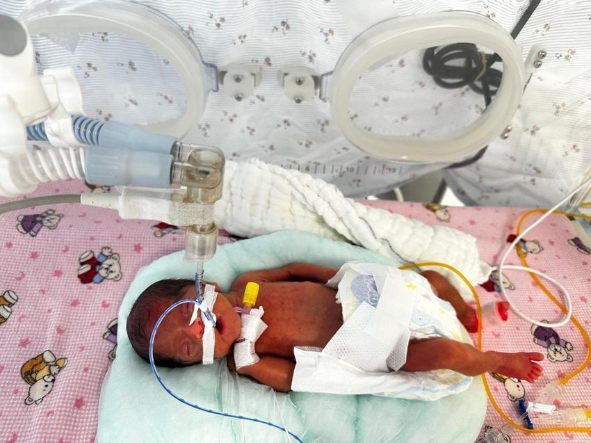 Antalya'da 650 gram doğan 'Leyloş bebek' hayata tutundu! 24 haftalık olarak dünyaya gelmişti