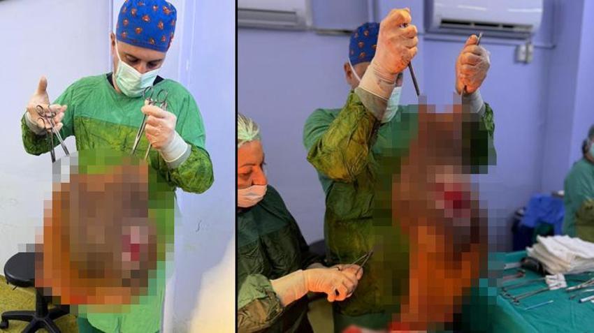 Tam 40 kilo! Doktorlar bile gözlerine inanamadı: Karnından çıkan kitle hayatını değiştirdi
