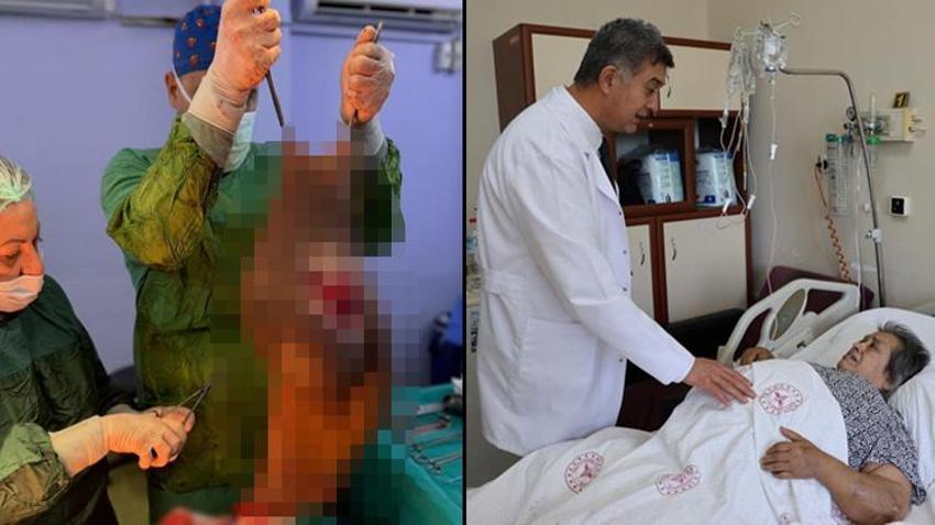 Tam 40 kilo! Doktorlar bile gözlerine inanamadı: Karnından çıkan kitle hayatını değiştirdi
