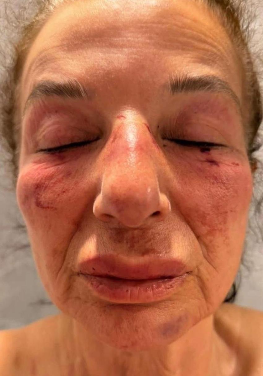 Yardıma çağırdığı kadını kemerle boğmaya çalıştı: İzmir'de korku dolu anlar