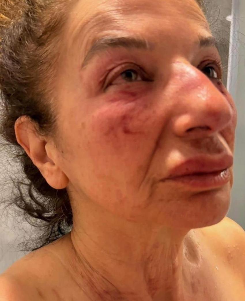 Yardıma çağırdığı kadını kemerle boğmaya çalıştı: İzmir'de korku dolu anlar