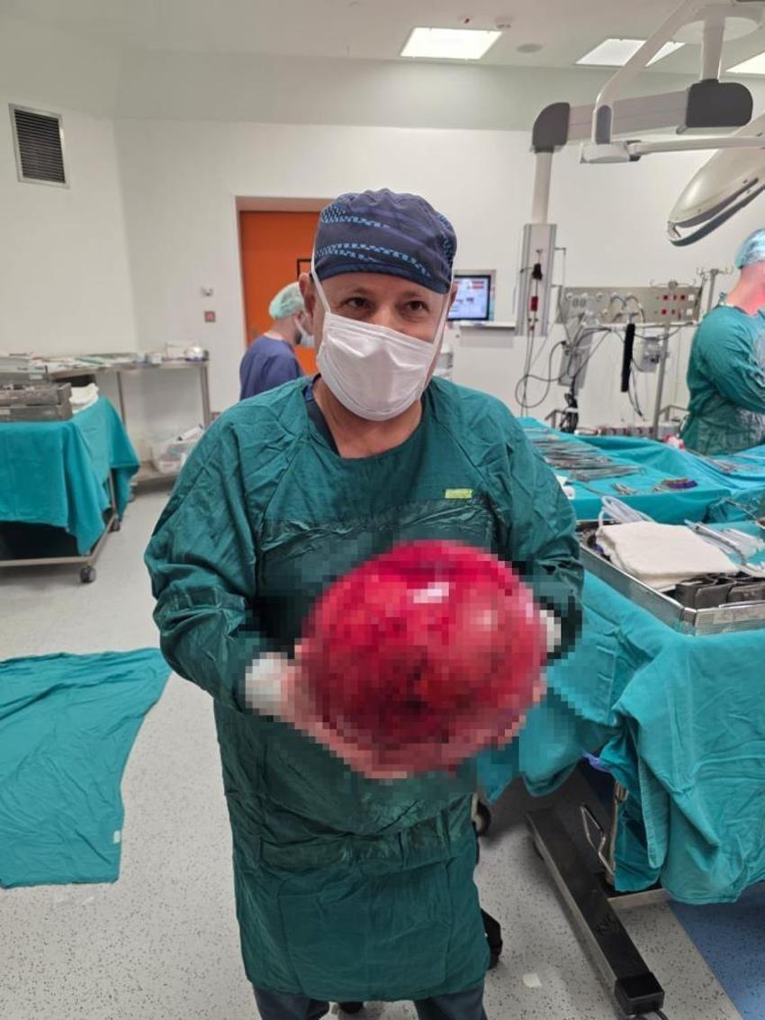 Kocaeli'de doktorlar inanamadı! Hastaneye geldi, 6,5 kilo çıktı: İlk defa bu kadar büyük gördüm