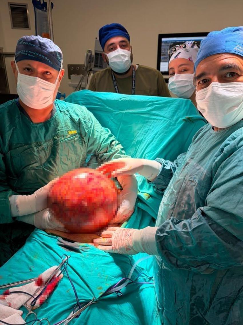 Kocaeli'de doktorlar inanamadı! Hastaneye geldi, 6,5 kilo çıktı: İlk defa bu kadar büyük gördüm