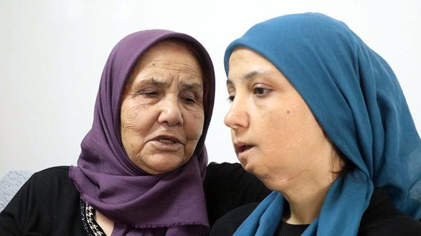 3 çocuk annesi kadın Gaziantep'te yardım bekliyor! 11 yılda 35 ameliyat geçirdi; son ameliyatı olmazsa dili alınacak