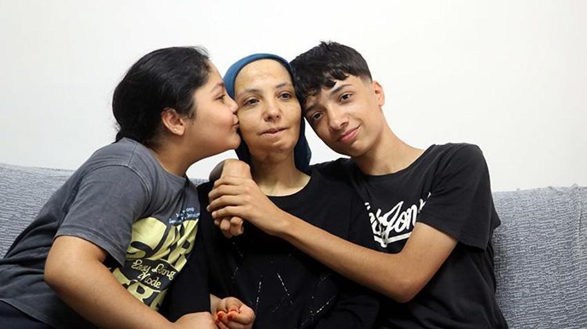 3 çocuk annesi kadın Gaziantep'te yardım bekliyor! 11 yılda 35 ameliyat geçirdi; son ameliyatı olmazsa dili alınacak