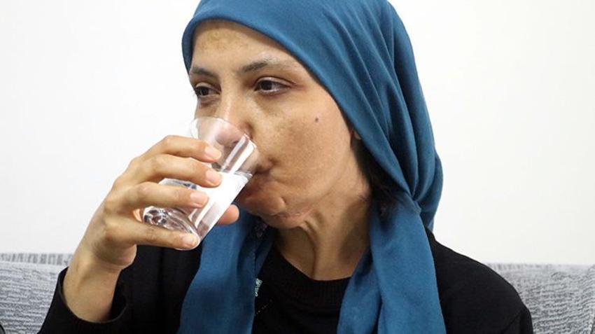 3 çocuk annesi kadın Gaziantep'te yardım bekliyor! 11 yılda 35 ameliyat geçirdi; son ameliyatı olmazsa dili alınacak