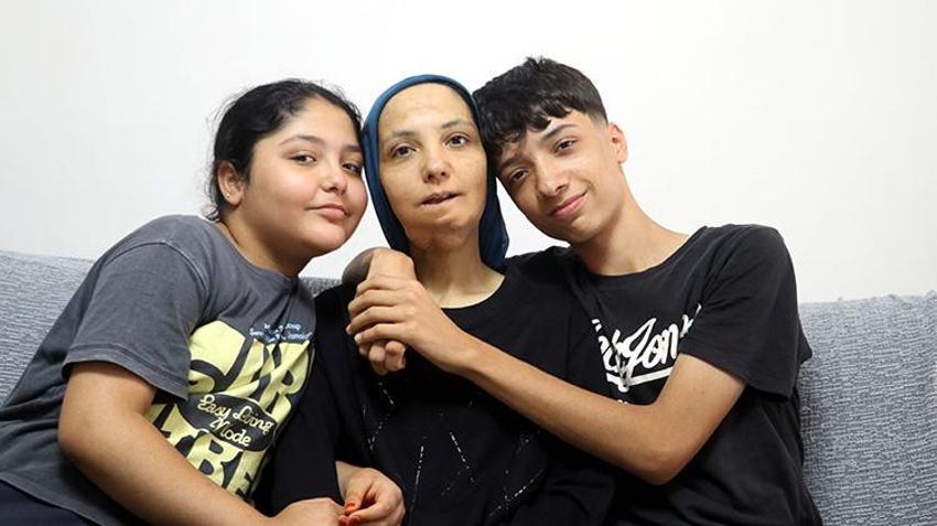 3 çocuk annesi kadın Gaziantep'te yardım bekliyor! 11 yılda 35 ameliyat geçirdi; son ameliyatı olmazsa dili alınacak