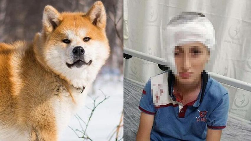 İzmir'de köpek saldırısı davasında karar verildi! Yüzünde kalıcı izler oluşan çocuğa rekor tazminat