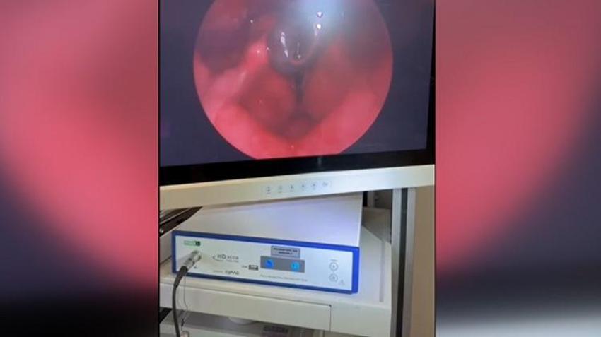 Doktorlar bile şaşkına döndü! Çeşmeden su içti, boğazından canlı canlı çıktı