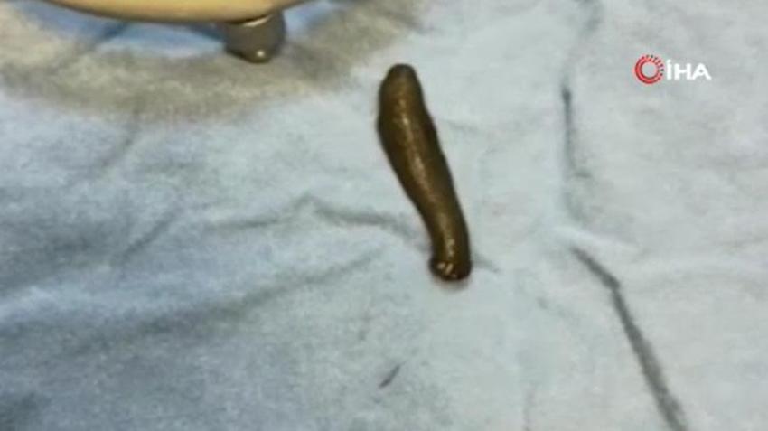 Doktorlar bile şaşkına döndü! Çeşmeden su içti, boğazından canlı canlı çıktı