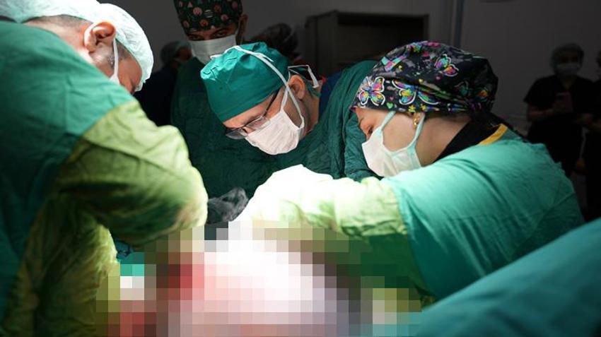 Karın ağrısı şikayetiyle gitti, hastanede şoke oldu! Nadir görülüyor: Tam 15 kilo çıktı